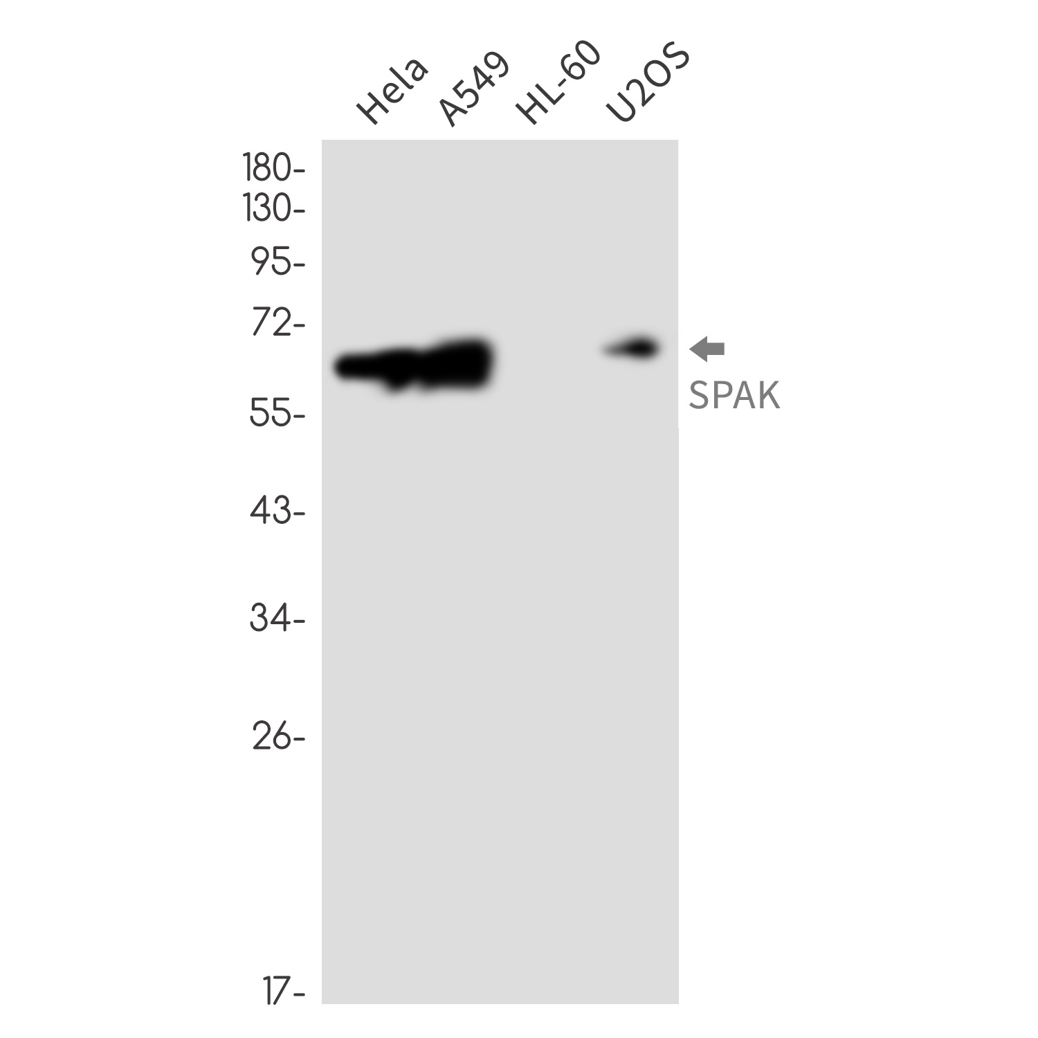 STK39 Antibody