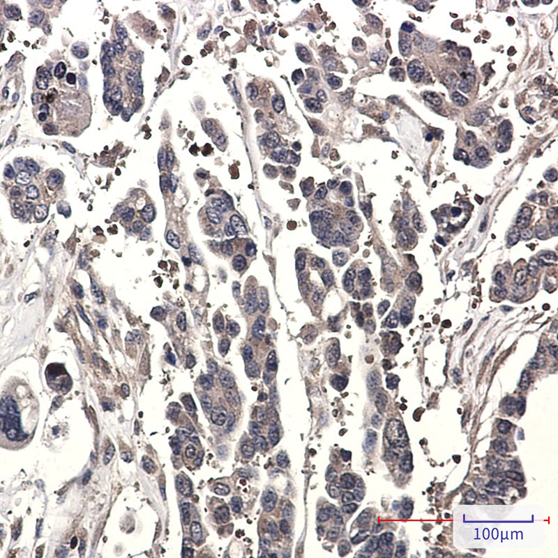 STK39 Antibody