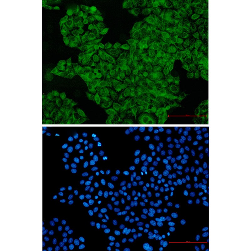 SNX1 Antibody
