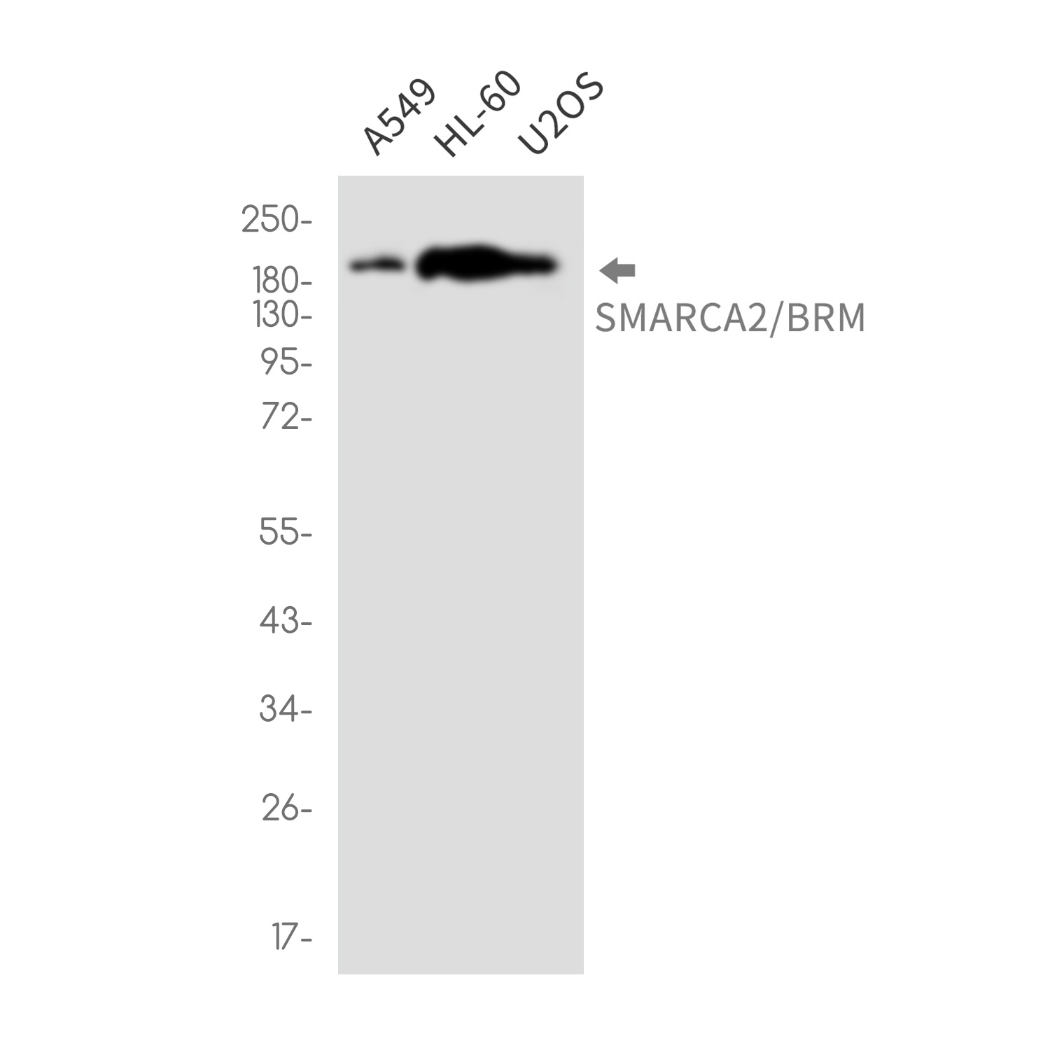 SMARCA2 Antibody