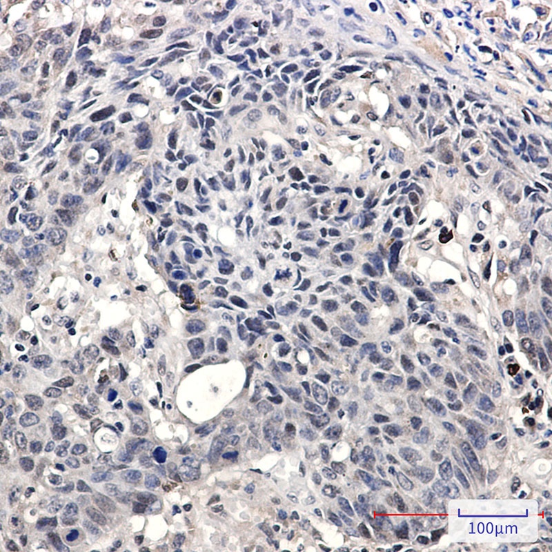 SMARCA2 Antibody