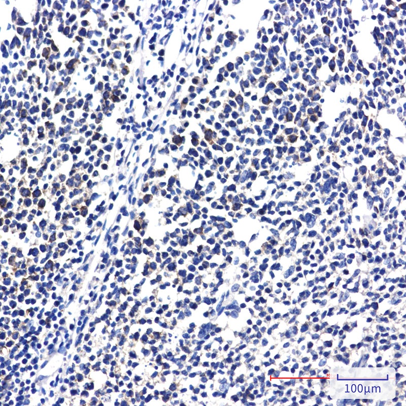 RPS20 Rabbit Monoclonal Antibody