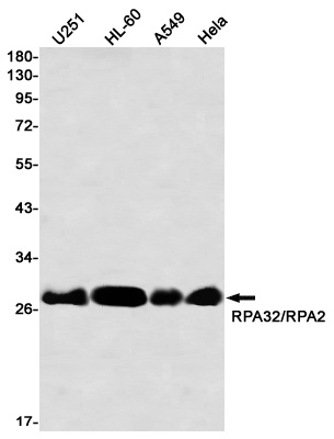 RPA32 Rabbit mAb