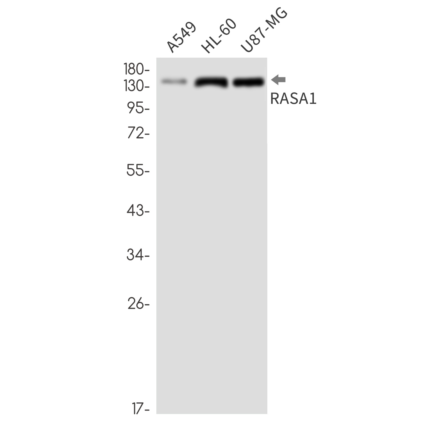 RASA1 Rabbit Monoclonal Antibody