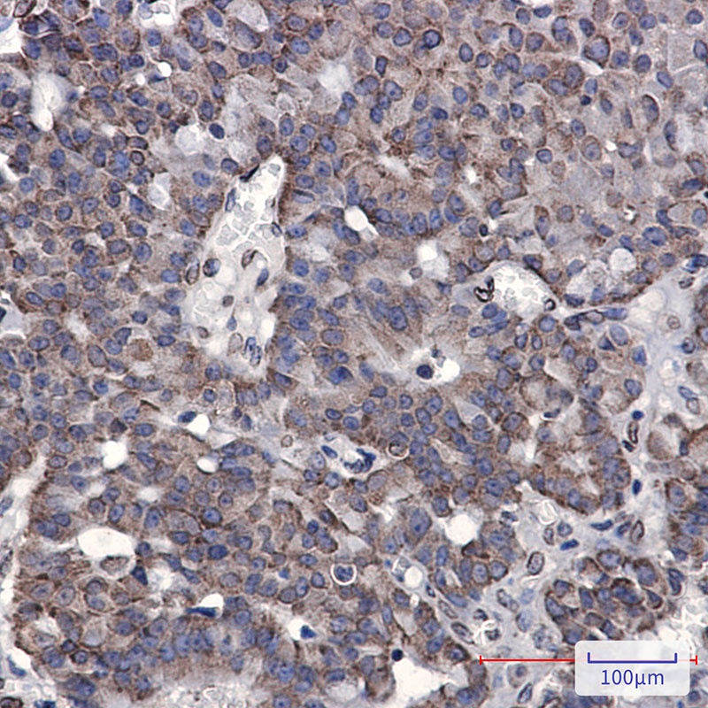 UIMC1 Antibody