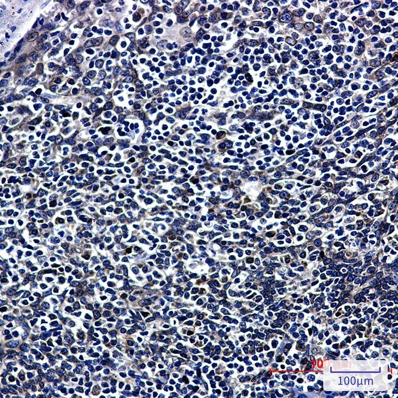 RanGAP1 Rabbit mAb