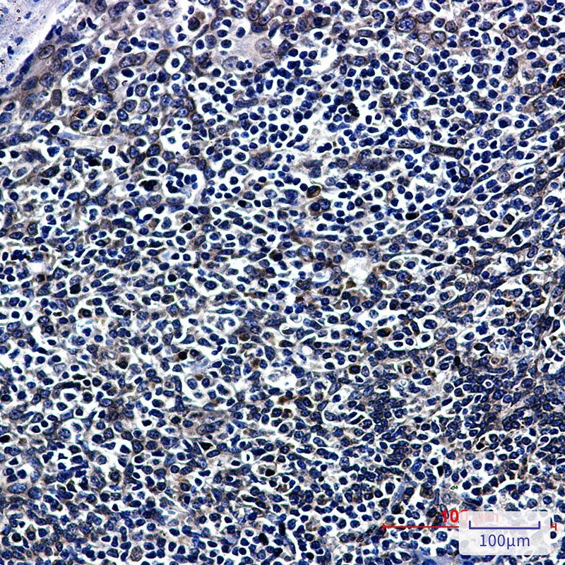 RANGAP1 Antibody