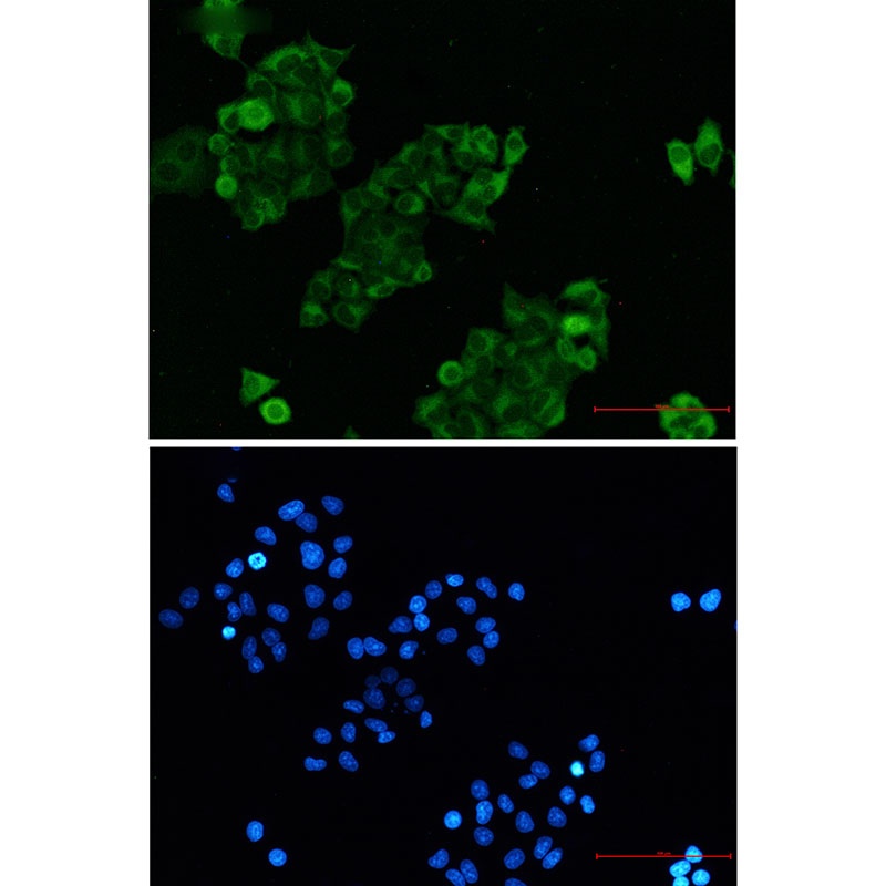 CRADD Antibody