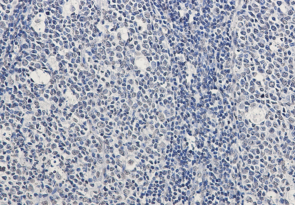 RAD51 Antibody