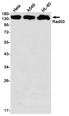 Rad50 Rabbit Monoclonal Antibody