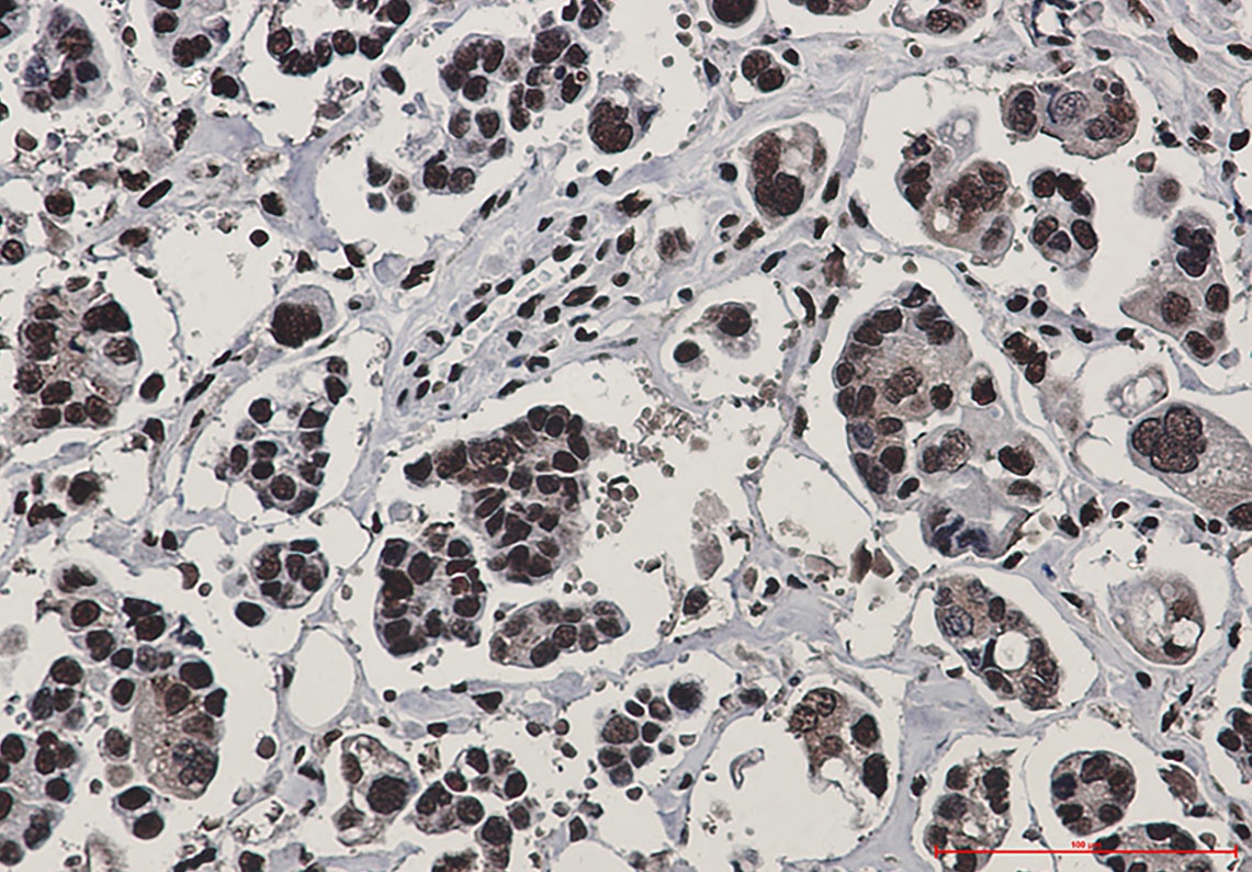Rad50 Rabbit Monoclonal Antibody