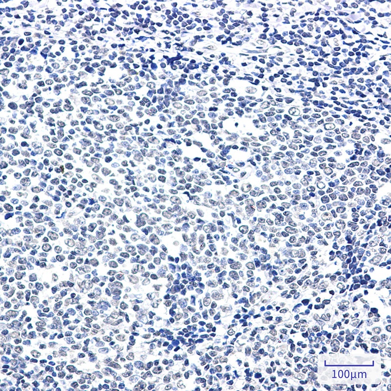 PTBP1 Antibody