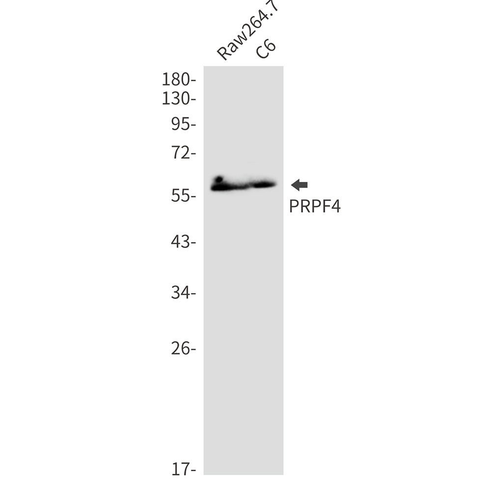 PRPF4 Rabbit mAb