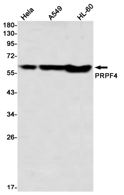 PRPF4 Rabbit mAb