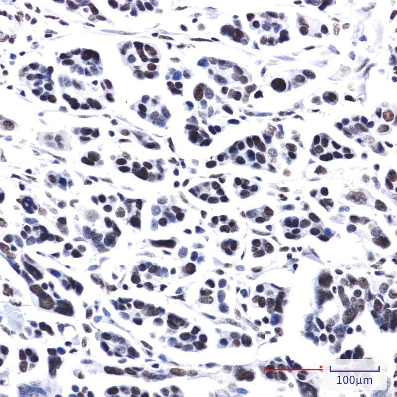 PRPF4 Rabbit mAb