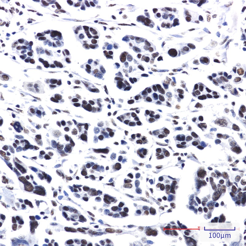 PRPF4 Antibody