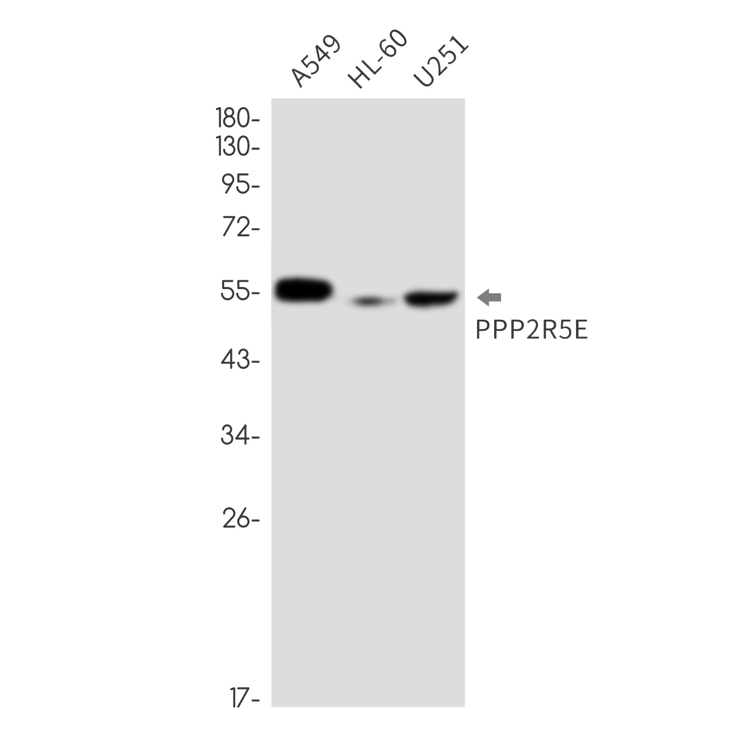 PPP2R5E Antibody