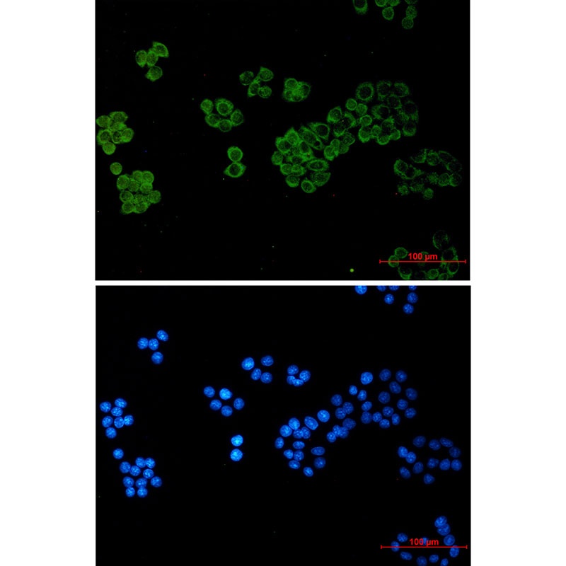 Phospholipase C gamma 1 Rabbit mAb