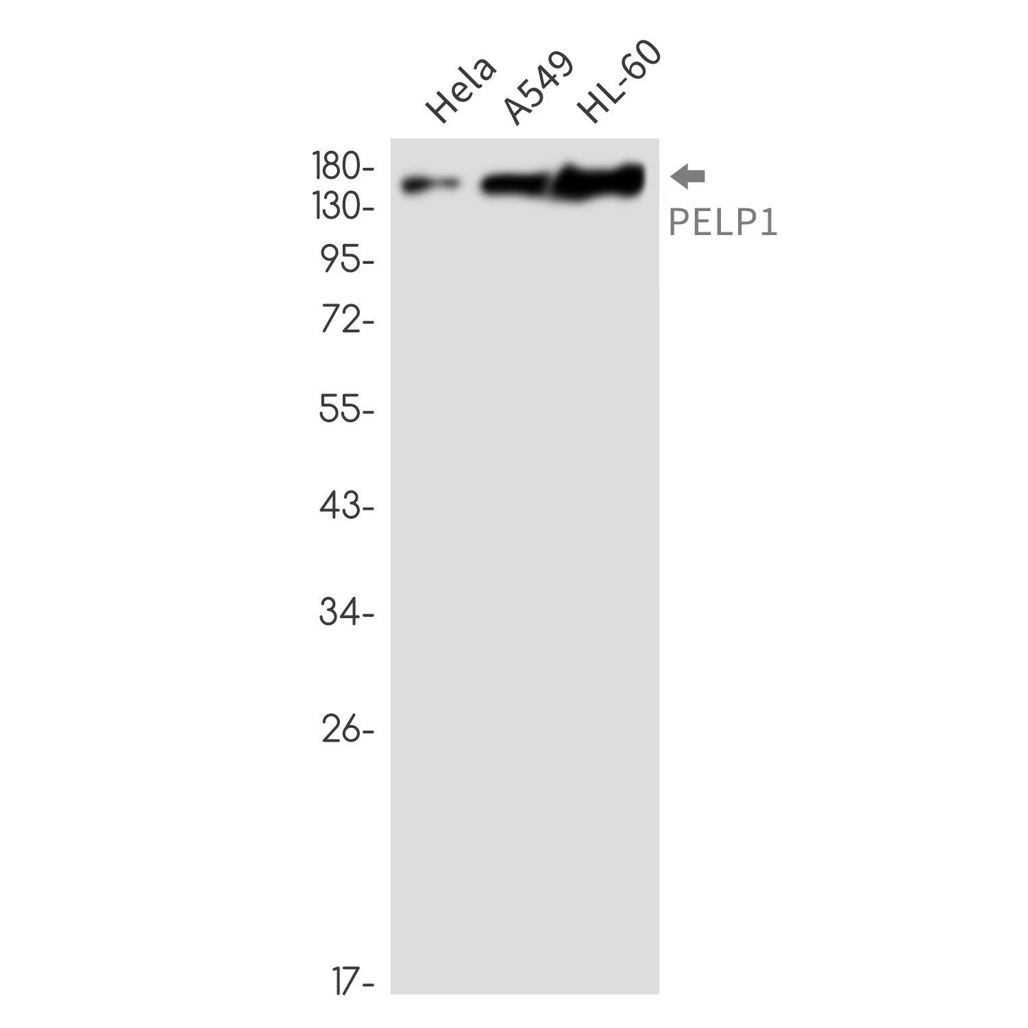 PELP1 Rabbit mAb