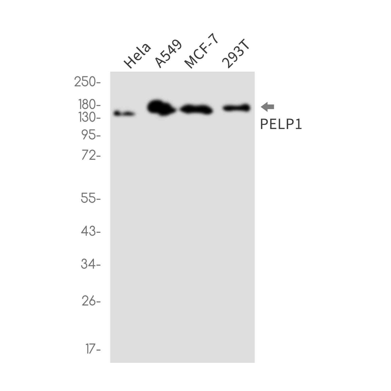 PELP1 Rabbit mAb
