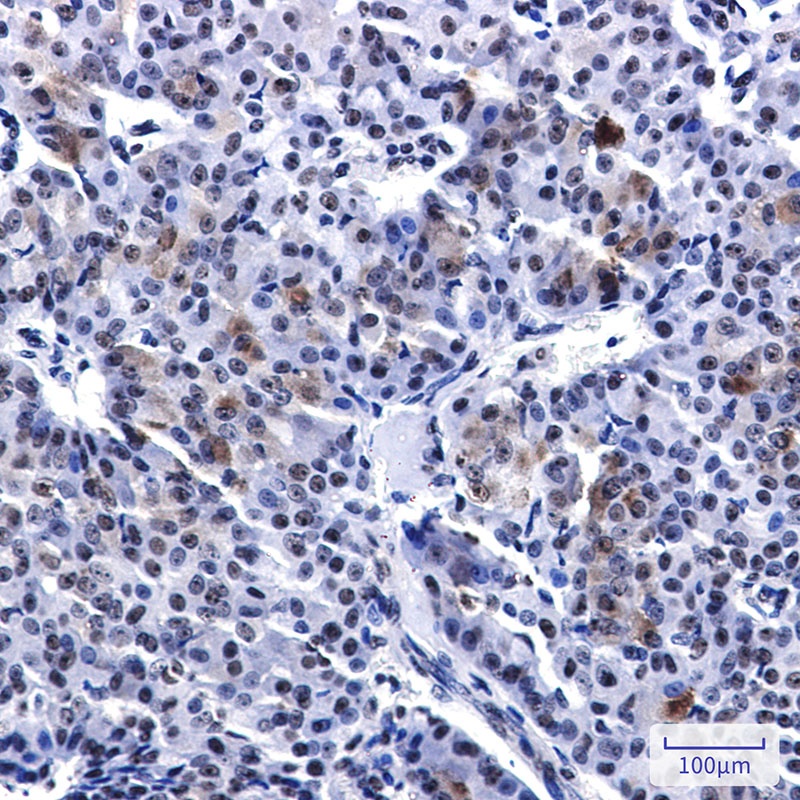 PELP1 Rabbit mAb