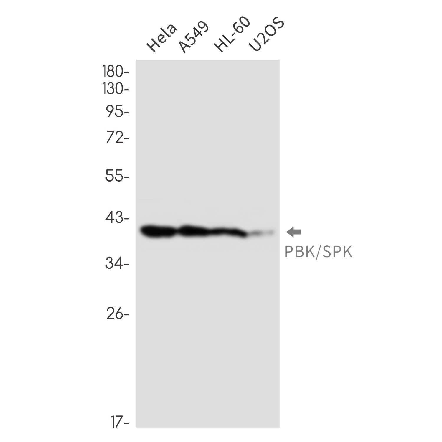 PBK Antibody