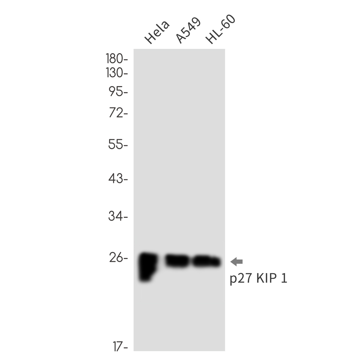 Cdkn1B Antibody
