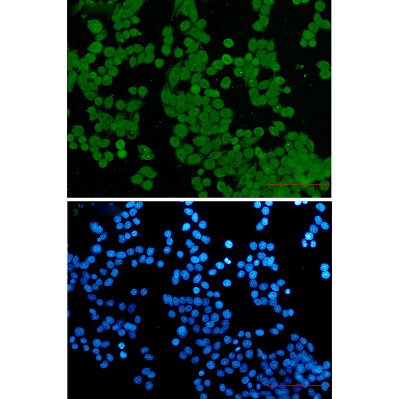 NUP50 Antibody