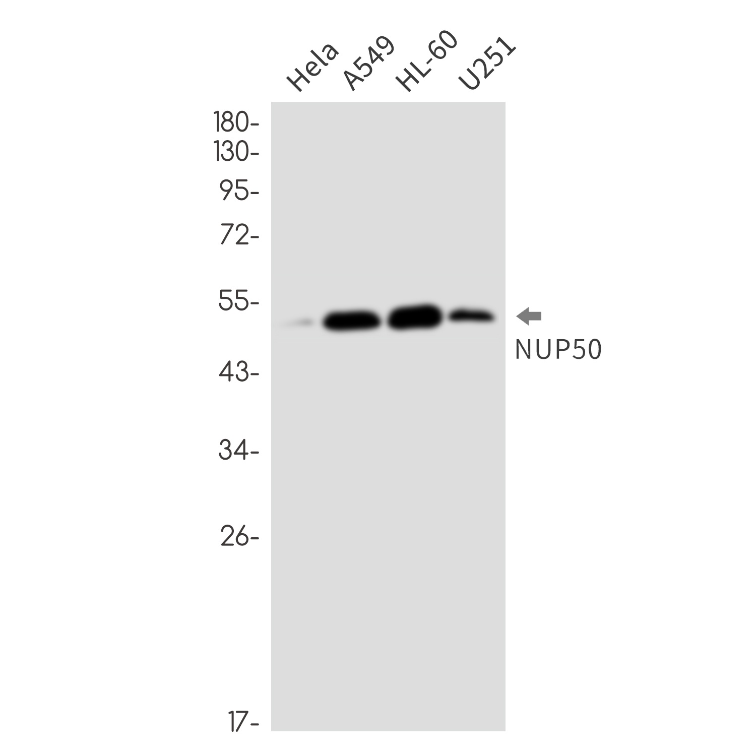 NUP50 Antibody