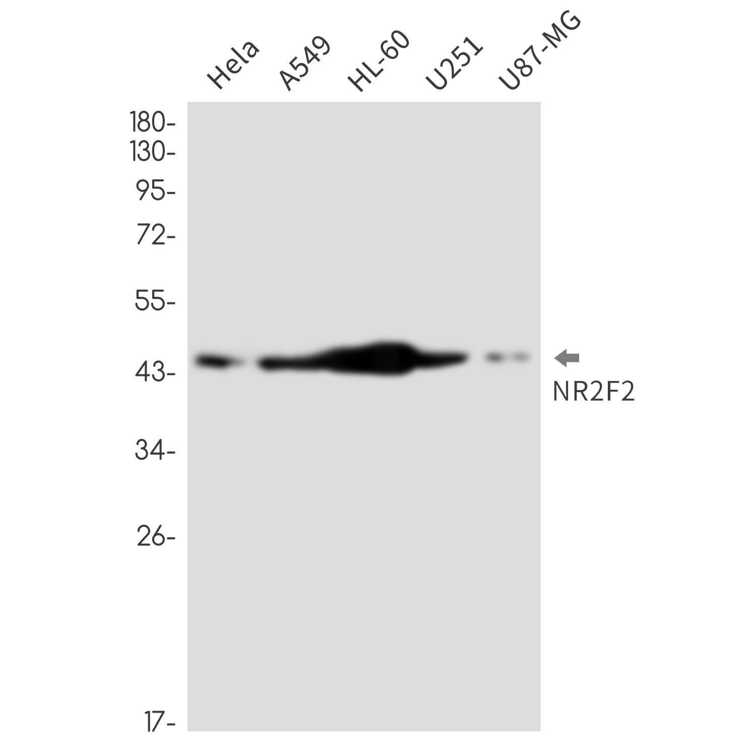 NR2F2 Antibody