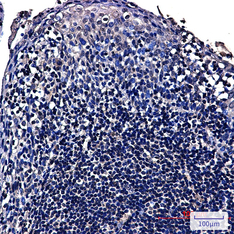 NOP10 Rabbit mAb