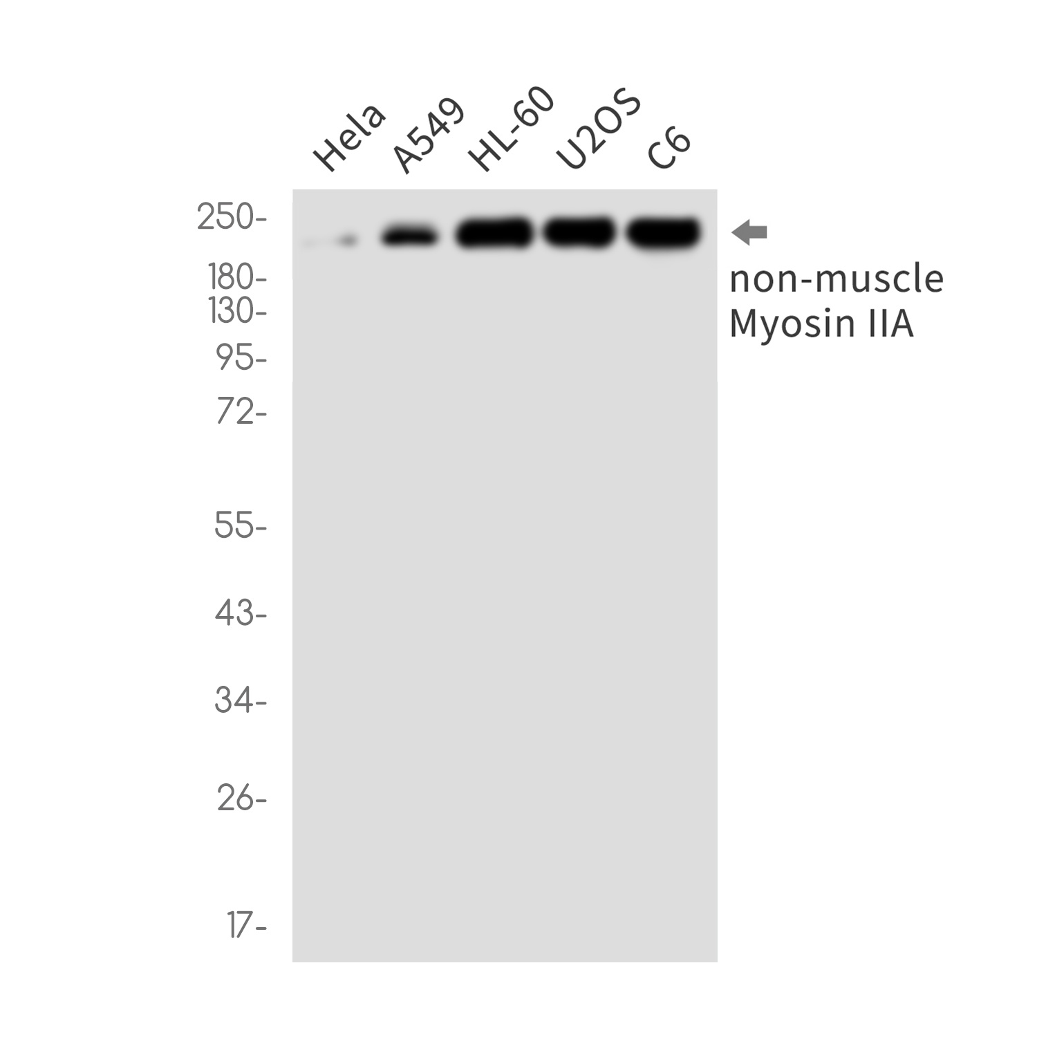 MYH9 Rabbit mAb