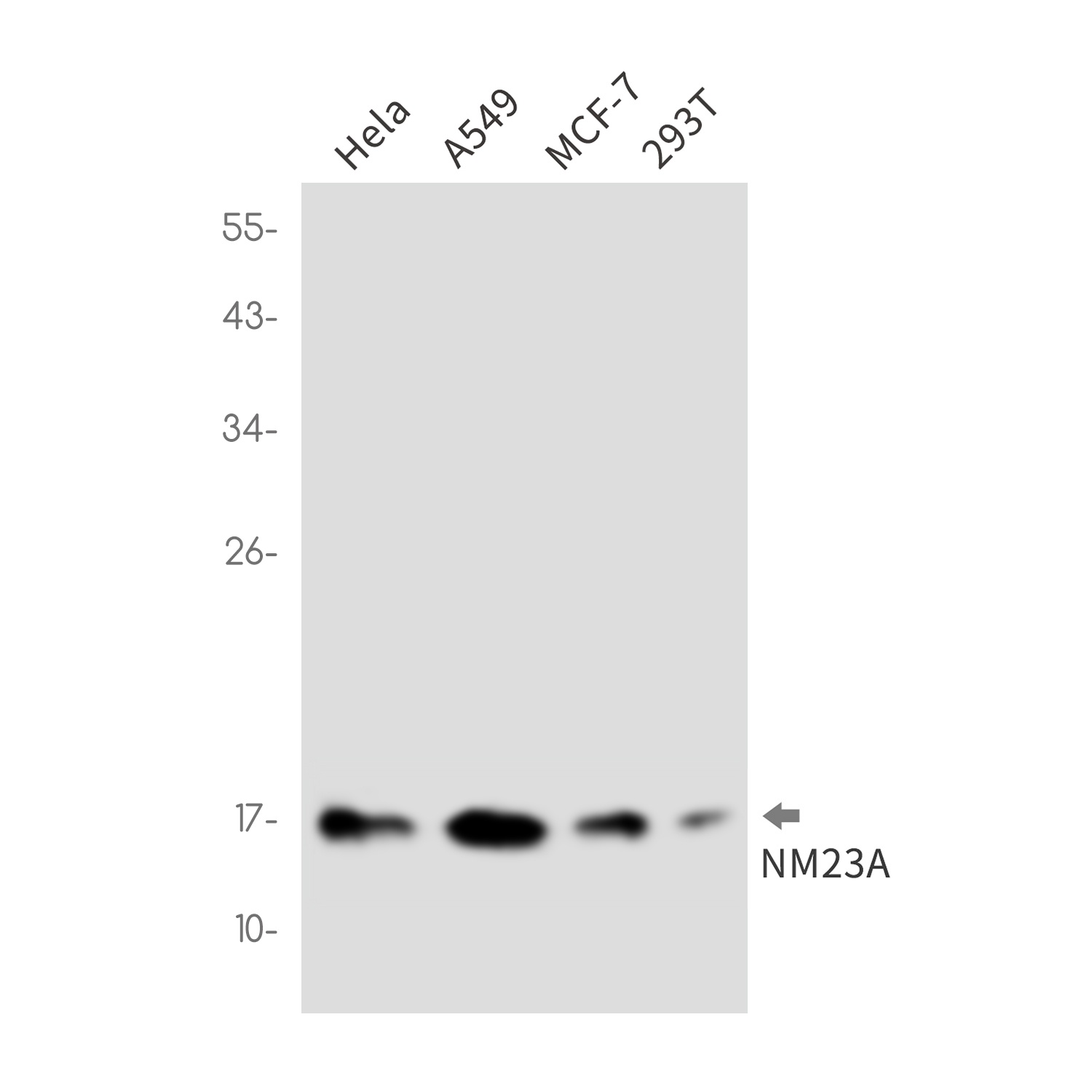 NM23A Rabbit Monoclonal Antibody