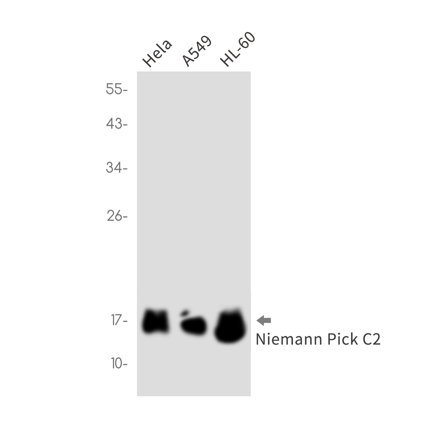 Niemann Pick C2 Rabbit mAb
