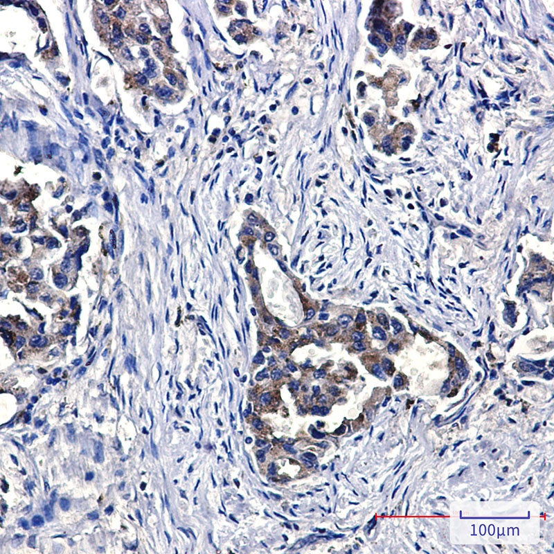Niemann Pick C2 Rabbit mAb