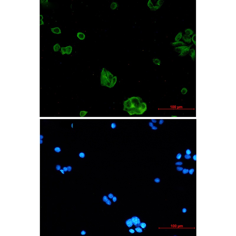 RTN4RL1 Antibody