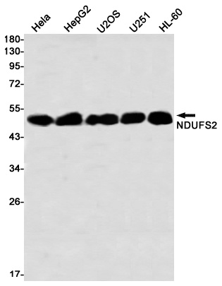 NDUFS2 Antibody