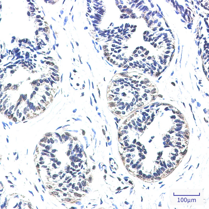 NDUFS2 Antibody