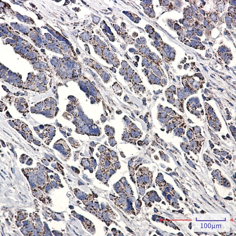 NDUFS1 Antibody