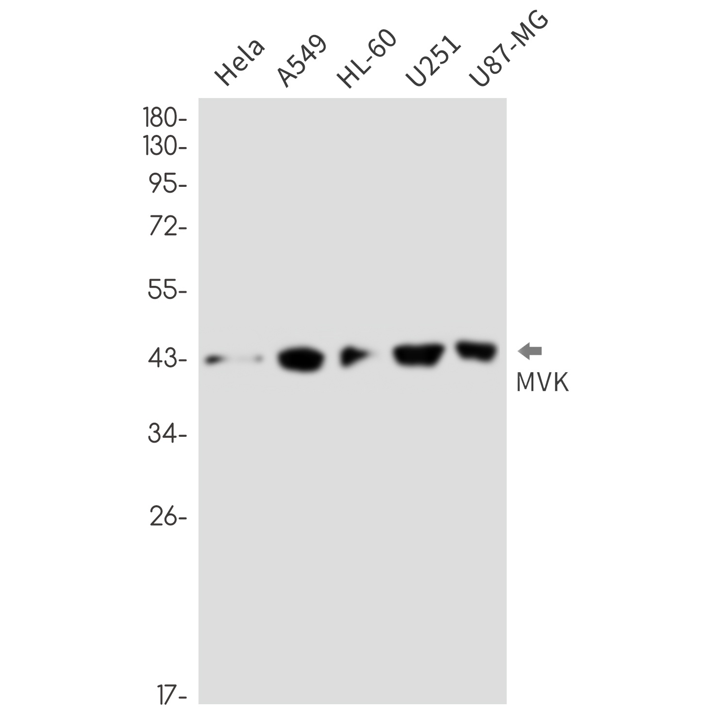 MVK Rabbit Monoclonal Antibody