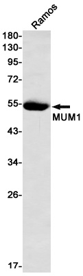IRF4 Rabbit Monoclonal Antibody