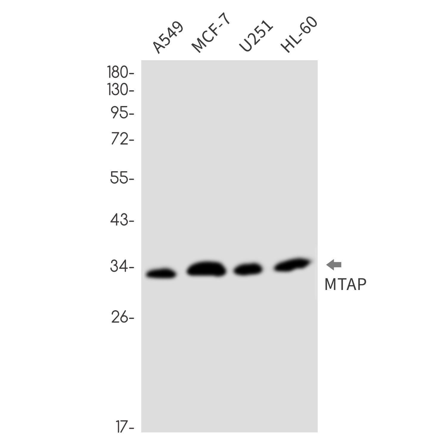 MTAP Rabbit mAb