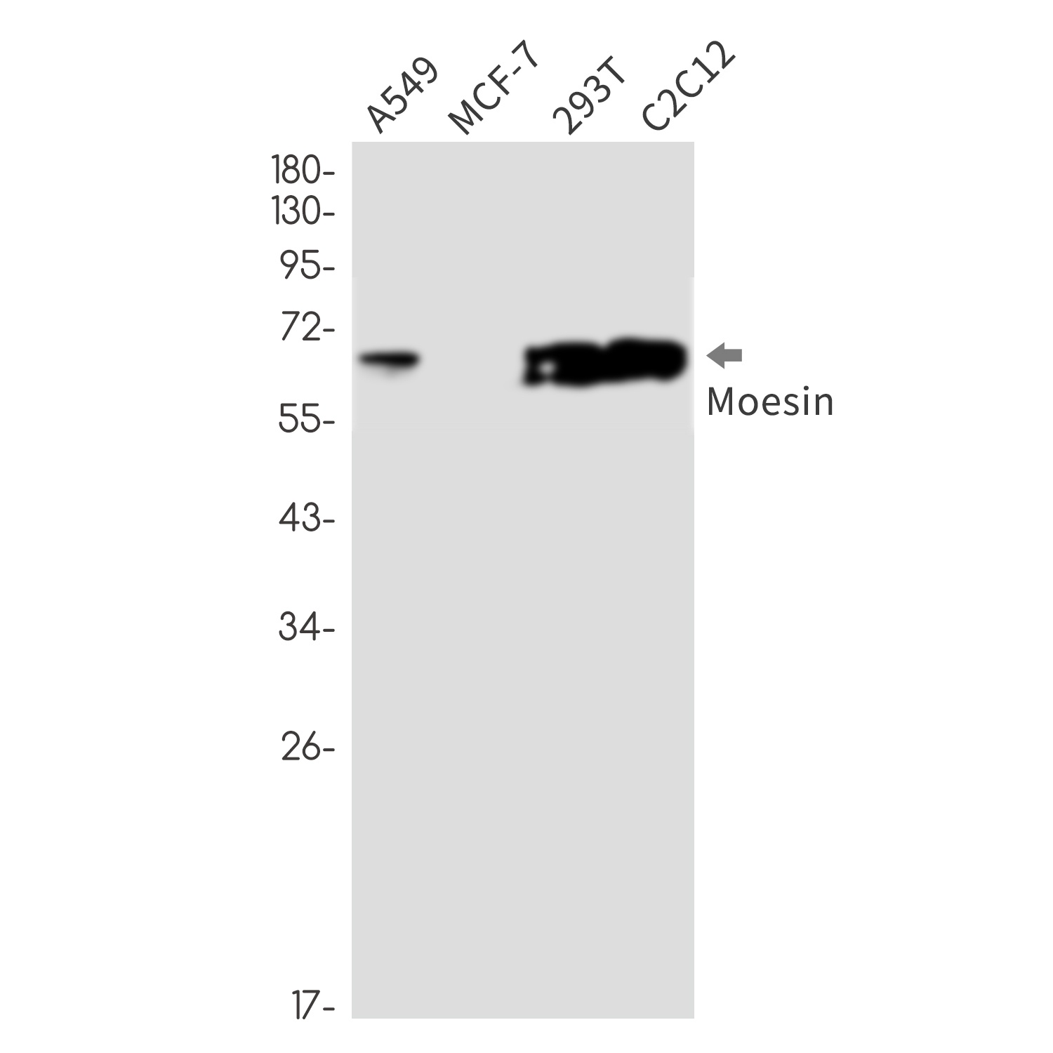 Moesin Rabbit mAb