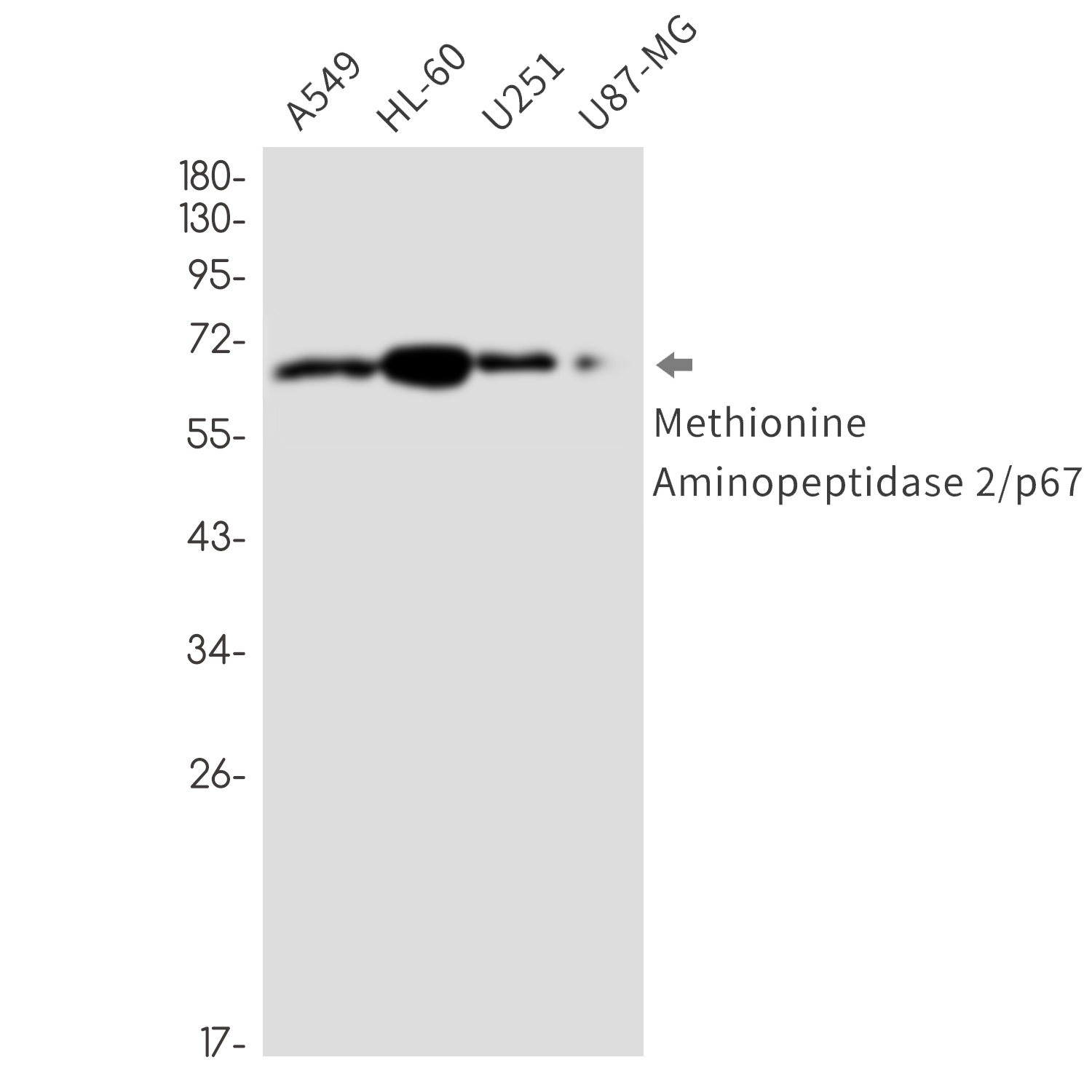 Methionine Aminopeptidase 2 Rabbit mAb