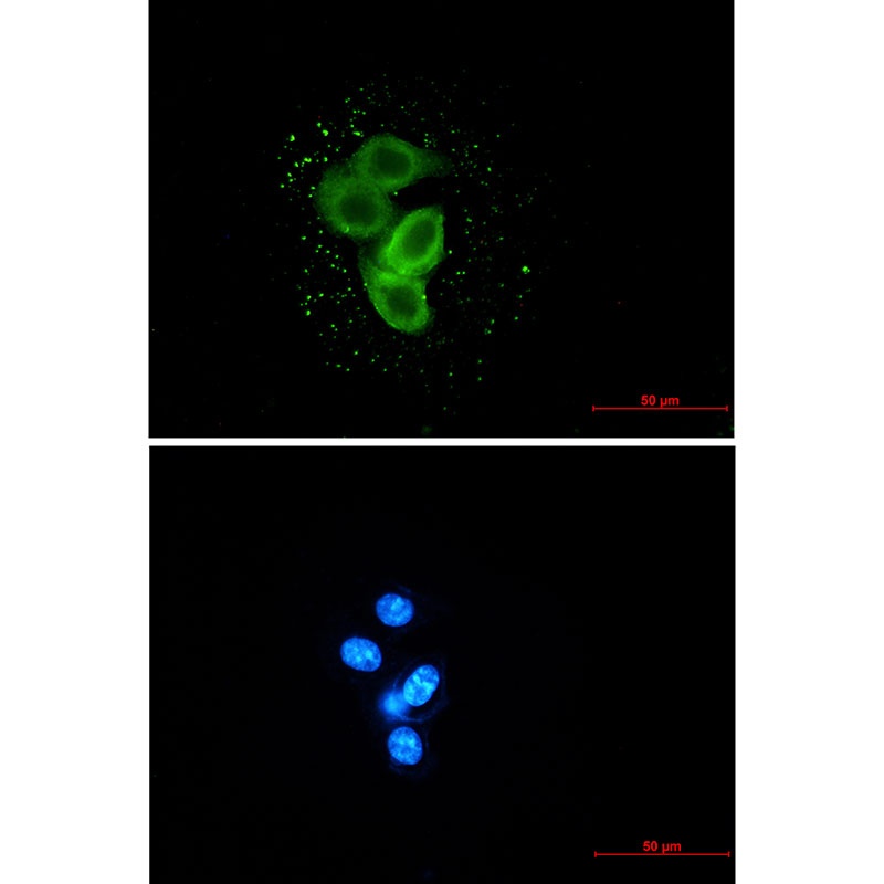 Meckelin Rabbit mAb