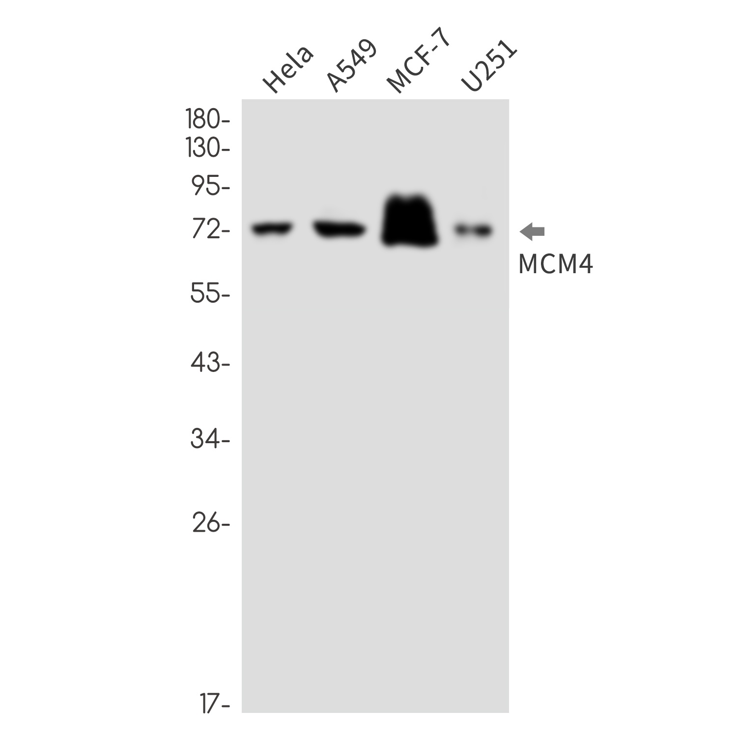 MCM4 Rabbit Monoclonal Antibody