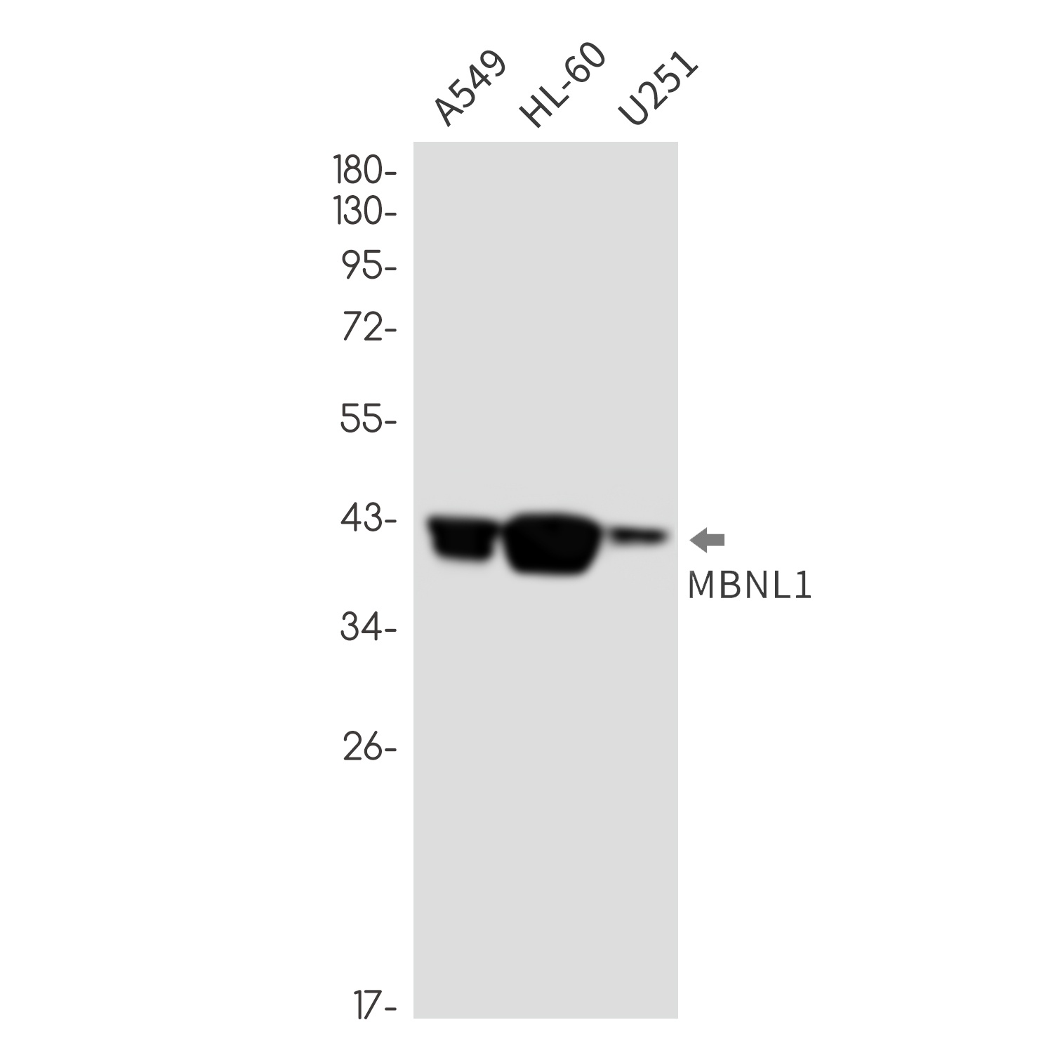 MBNL1 Rabbit mAb