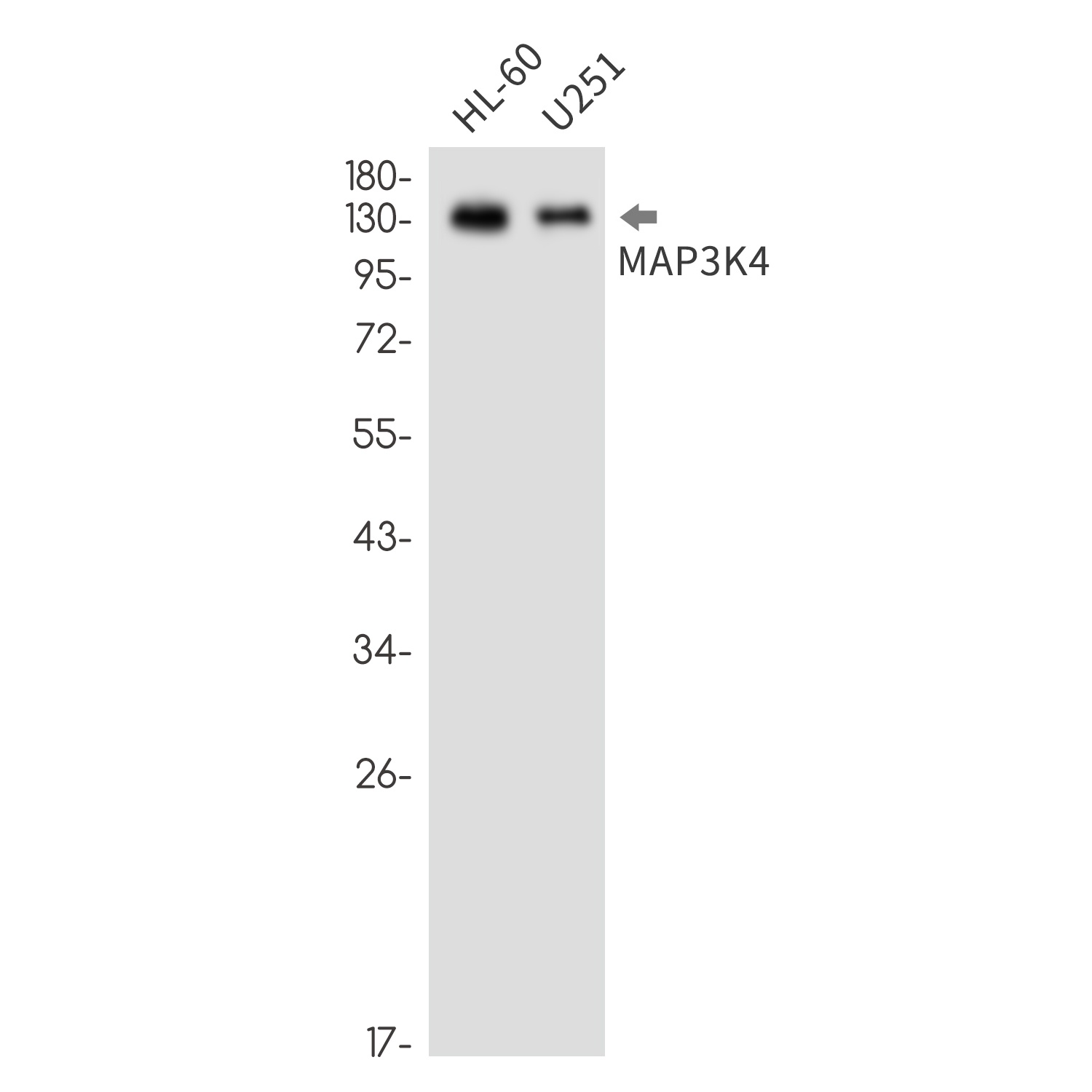 MAP3K4 Antibody