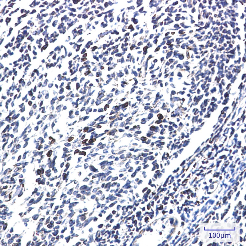 MTDH Antibody