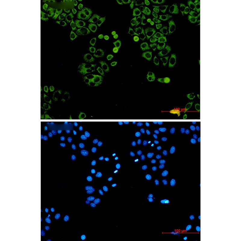 MTDH Antibody